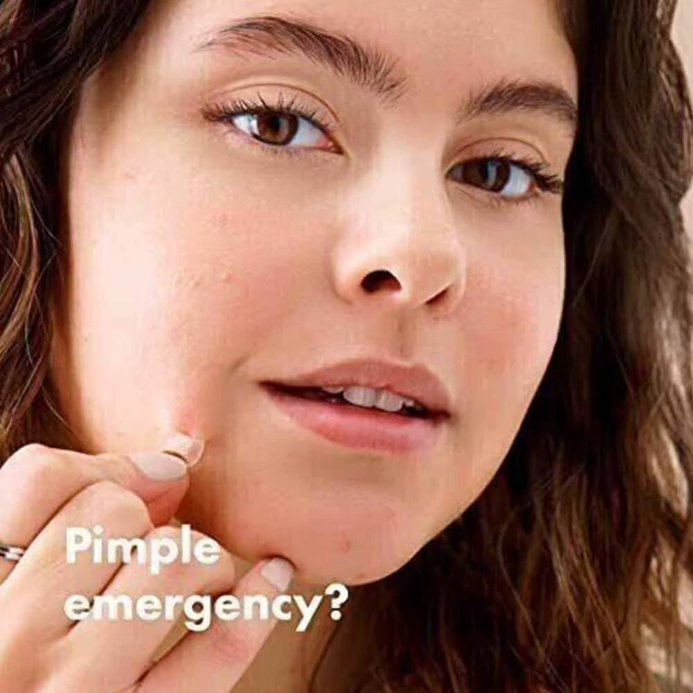 Hydrogel Acne Patch Invisible Closed Mouth Invisible Acne Face Invisible Waterproof and Breathable Skin Patch Skin Care Tools