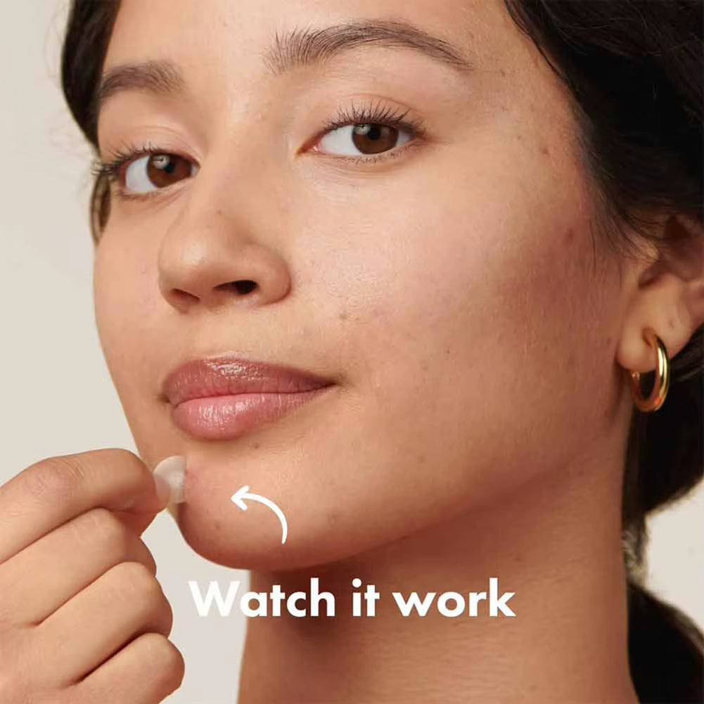 Hydrogel Acne Patch Invisible Closed Mouth Invisible Acne Face Invisible Waterproof and Breathable Skin Patch Skin Care Tools